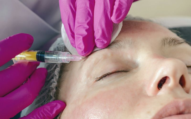 Botox (toxină botulinică)