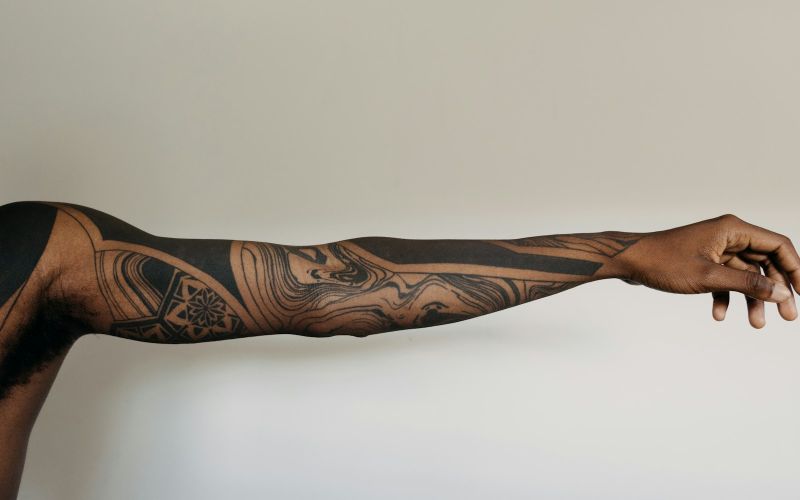 Îndepărtare tatuaje cu laser